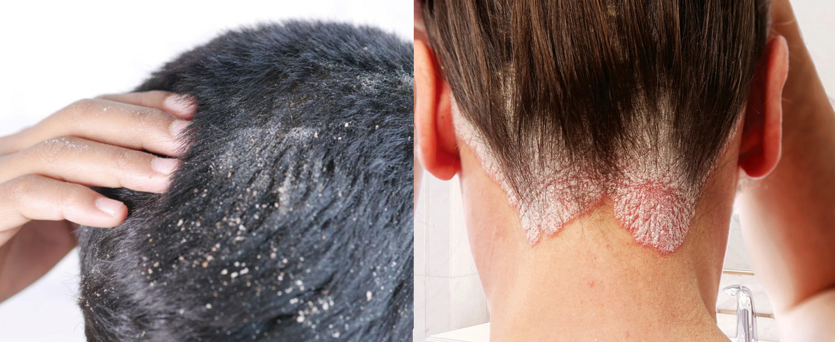 Looking for Amanda Shampoo? Here’s a Better Alternative