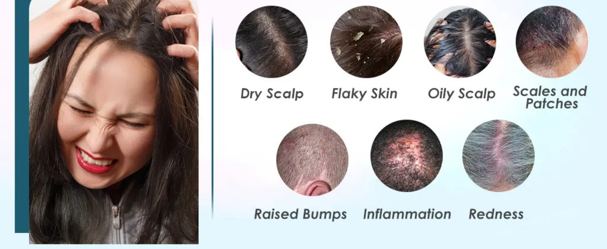 Best Shampoo for Itchy Scalp