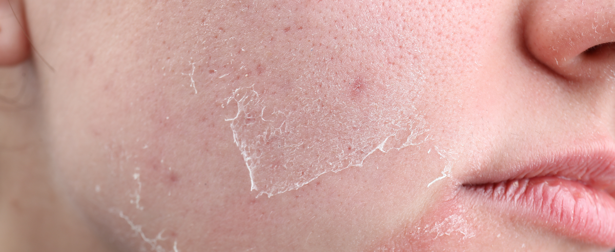 5 Habits That Making Your Skin Look Dull and How to Fix Them