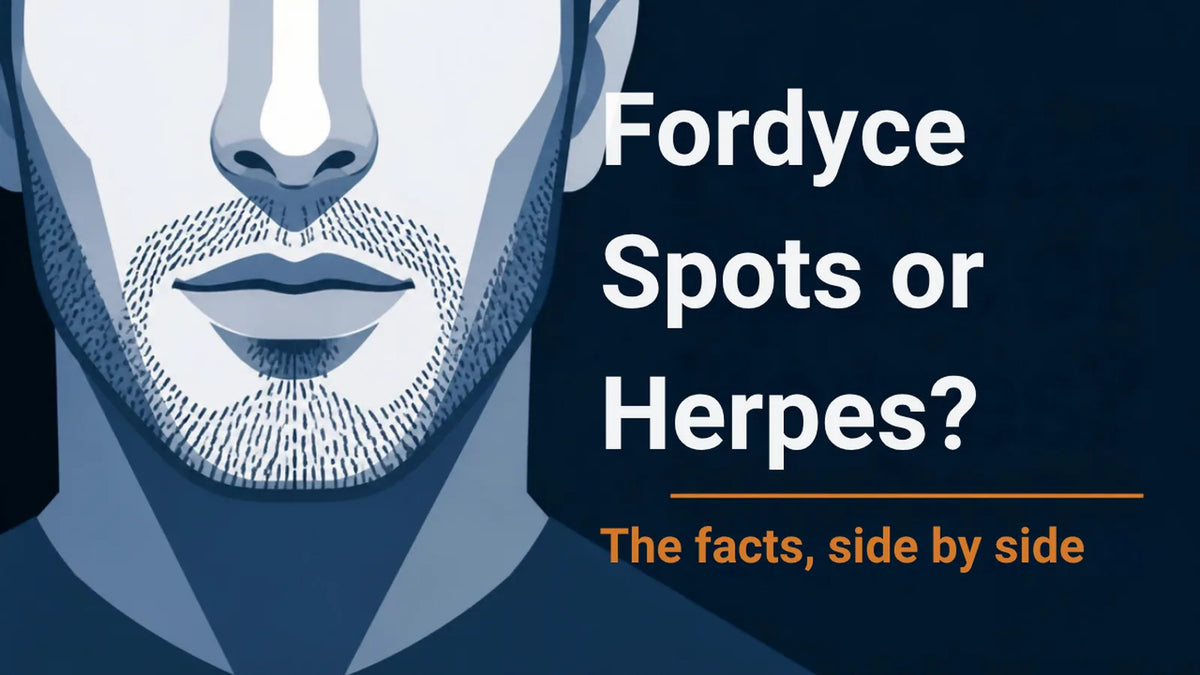 Illustration of a man's lower face with the title Fordyce Spots or Herpes? The facts, side by side