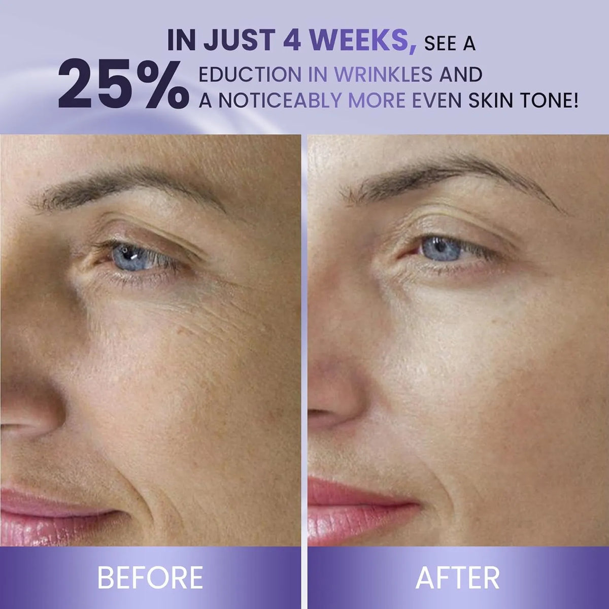 Belani Retinol Face Cream - Advanced Anti-Aging Night Moisturizer