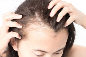 Hair Loss & Thinning