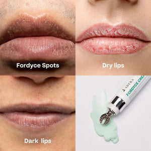 Close-ups of lips with Fordyce spots, dry lips and dark lips beside an ABERA Fordyce Cream tube and cream swatch