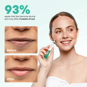 Before and after photos of lips next to a smiling woman holding ABERA Fordyce Cream, with a 5-week user survey result
